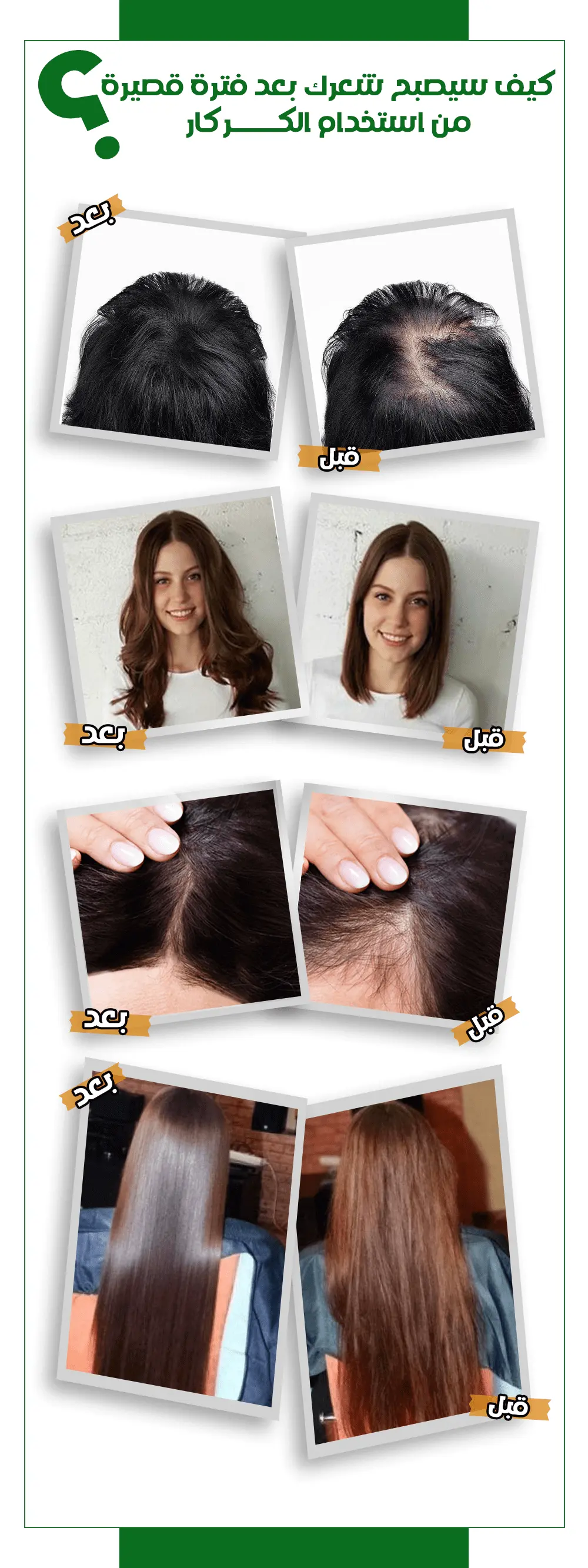 مجموعة الكركار لتطويل الشعر